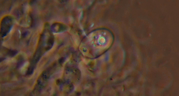 Quale Hyphoderma? (H. praetermissum?)